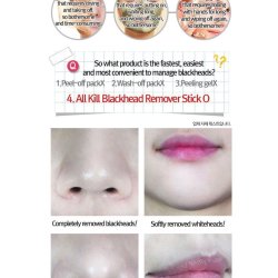 RiRe - All Kill Blackhead Remover Stick